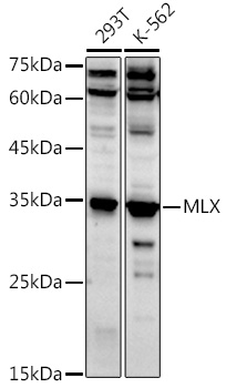 Western blot analysis of extracts of various cell lines using MLX Polyclonal Antibody at 1:1000 dilution.