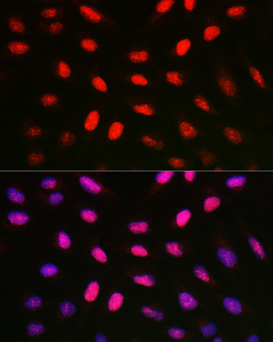 Immunofluorescence analysis of U2OS cells using HIST1H1A Polyclonal Antibody at dilution of 1:50 (40x lens). Blue: DAPI for nuclear staining.