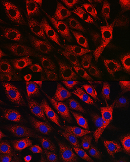 Immunofluorescence analysis of NIH/3T3 cells using UFL1 Polyclonal Antibody at dilution of 1:50 (40x lens). Blue: DAPI for nuclear staining.