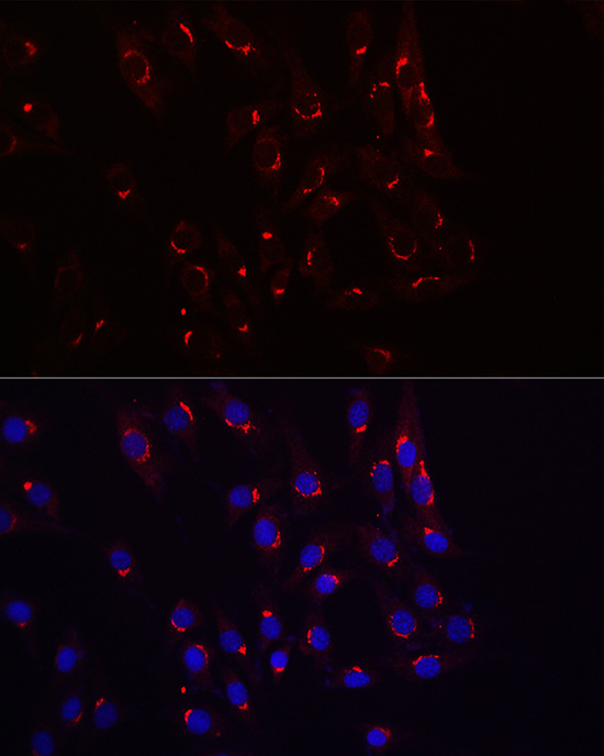 Immunofluorescence analysis of NIH/3T3 cells using TJAP1 Polyclonal Antibody atdilution of 1:100 (40x lens). Blue: DAPI for nuclear staining.