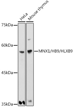 Western blot analysis of extracts of various cell lines using MNX1/HB9/HLXB9 Polyclonal Antibody at 1:1000 dilution.