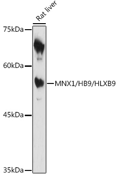 Western blot analysis of extracts of Rat liver using MNX1/HB9/HLXB9 Polyclonal Antibody at 1:1000 dilution.