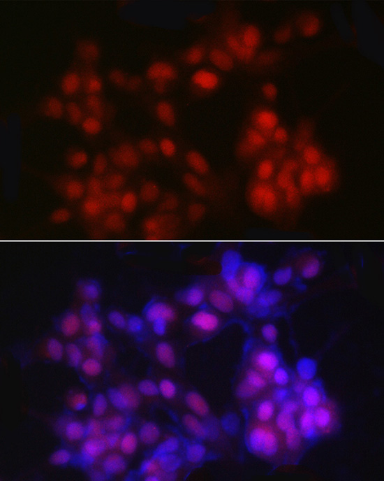 Immunofluorescence analysis of LNCaP cells using NKX3.1 Polyclonal Antibody at dilution of 1:20 (40x lens). Blue: DAPI for nuclear staining.