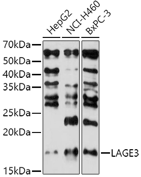 Western blot analysis of extracts of various cell lines using LAGE3 Polyclonal Antibody at 1:1000 dilution.