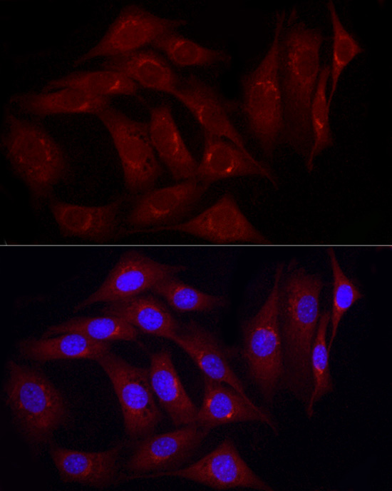 Immunofluorescence analysis of NIH/3T3 cells using Caveolin-2 Polyclonal Antibody at dilution of 1:100 (40x lens). Blue: DAPI for nuclear staining.