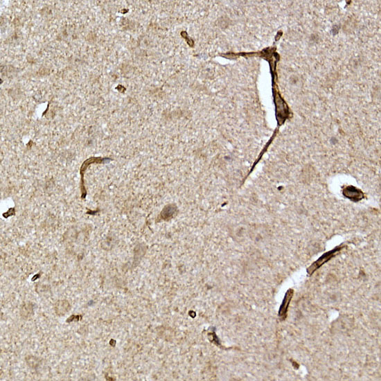 Immunohistochemistry of paraffin-embedded rat brain using Caveolin-2 Polyclonal Antibody at dilution of 1:100 (40x lens).Perform high pressure antigen retrieval with 10 mM citrate buffer pH 6.0 before commencing with IHC staining protocol.