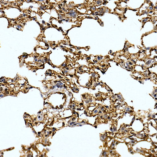 Immunohistochemistry of paraffin-embedded rat lung using Caveolin-2 Polyclonal Antibody at dilution of 1:100 (40x lens).Perform high pressure antigen retrieval with 10 mM citrate buffer pH 6.0 before commencing with IHC staining protocol.