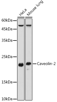 Western blot analysis of extracts of various cell lines using Caveolin-2 Polyclonal Antibody at 1:1000 dilution.