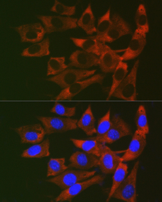 Immunofluorescence analysis of NIH/3T3 cells using RPL19 Polyclonal Antibody at dilution of 1:200 (40x lens). Blue: DAPI for nuclear staining.