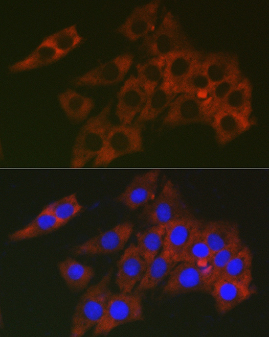 Immunofluorescence analysis of PC-12 cells using RPL19 Polyclonal Antibody at dilution of 1:200 (40x lens). Blue: DAPI for nuclear staining.