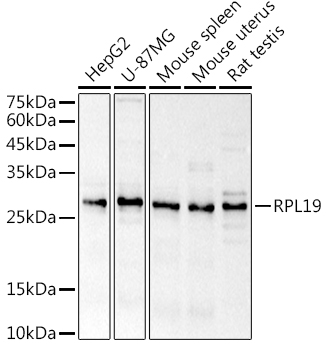 Western blot analysis of extracts of various cell lines using RPL19 Polyclonal Antibody at 1:1000 dilution.