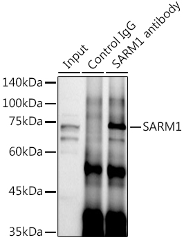 Immunoprecipitation analysis of 300ug extracts of SH-SY5Y cells using 3ug SARM1 Polyclonal Antibody.Western blot was performed from the immunoprecipitate using SARM1 Polyclonal Antibody at a dilution of 1:1000.