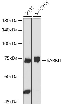 Western blot analysis of extracts of various cell lines using SARM1 Polyclonal Antibody at 1:1000 dilution.