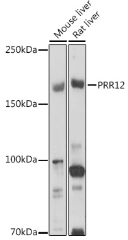 Western blot analysis of extracts of various cell lines using PRR12 Polyclonal Antibody at 1:1000 dilution.