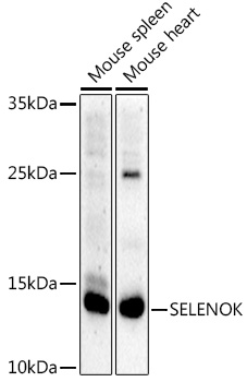 Western blot analysis of extracts of various cell lines using SELENOK Polyclonal Antibody at 1:1000 dilution.