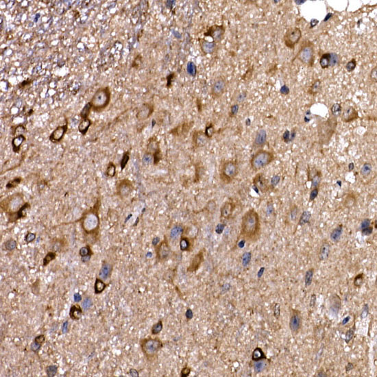 Immunohistochemistry of paraffin-embedded mouse spinal cord using DYNC1LI2 Polyclonal Antibody at dilution of 1:20 (40x lens).Perform high pressure antigen retrieval with 10 mM citrate buffer pH 6.0 before commencing with IHC staining protocol.