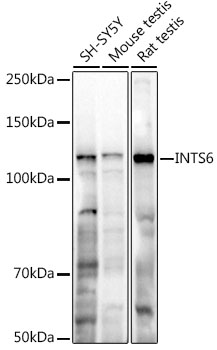 Western blot analysis of extracts of various cell lines using INTS6 Polyclonal Antibody at 1:1000 dilution.