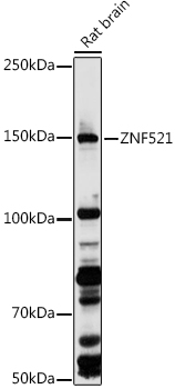 Western blot analysis of extracts of Rat brain using ZNF521 Polyclonal Antibody at 1:1000 dilution.