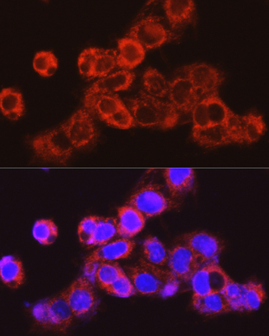 Immunofluorescence analysis of HepG2 cells using UGT2B17 Polyclonal Antibody atdilution of 1:200 (40x lens). Blue: DAPI for nuclear staining.