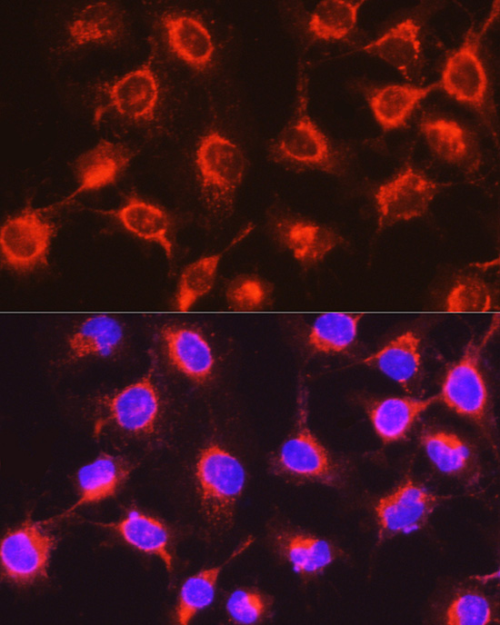 Immunofluorescence analysis of PC-3 cells using UGT2B17 Polyclonal Antibody at dilution of 1:200 (40x lens). Blue: DAPI for nuclear staining.