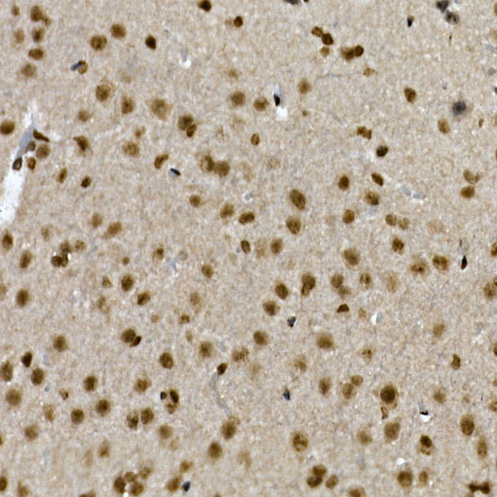 Immunohistochemistry of paraffin-embedded mouse brain using ZNF213 Polyclonal Antibody at dilution of 1:100 (40x lens).Perform high pressure antigen retrieval with 10 mM citrate buffer pH 6.0 before commencing with IHC staining protocol.