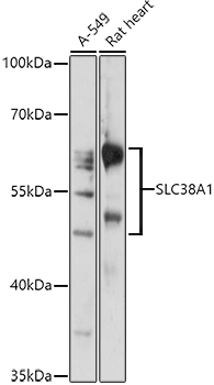 Western blot analysis of extracts of various cell lines using SLC38A1 Polyclonal Antibody at 1:1000 dilution.