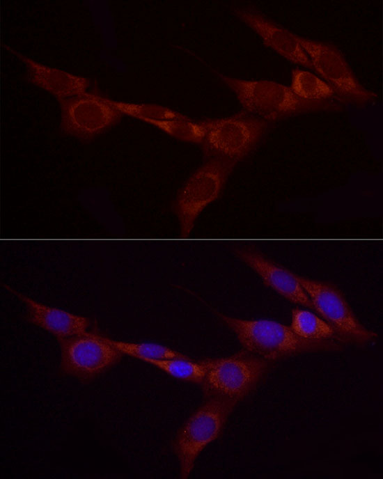 Immunofluorescence analysis of NIH/3T3 cells using Bcdin3d Polyclonal Antibody at dilution of 1:20 (40x lens). Blue: DAPI for nuclear staining.