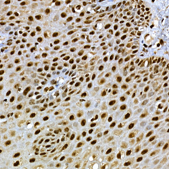 Immunohistochemistry of paraffin-embedded human esophagus using SCAF4 Polyclonal Antibody at dilution of 1:50 (40x lens).Perform high pressure antigen retrieval with 10 mM citrate buffer pH 6.0 before commencing with IHC staining protocol.