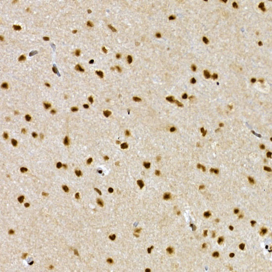 Immunohistochemistry of paraffin-embedded rat brain using SCAF4 Polyclonal Antibody at dilution of 1:50 (40x lens).Perform high pressure antigen retrieval with 10 mM citrate buffer pH 6.0 before commencing with IHC staining protocol.