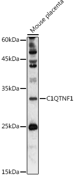 Western blot analysis of extracts of Mouse placenta using C1QTNF1 Polyclonal Antibody at 1:1000 dilution.