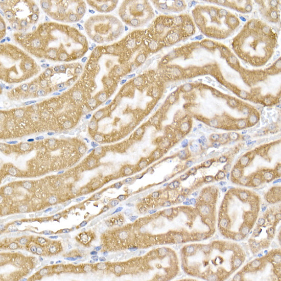 Immunohistochemistry of paraffin-embedded mouse kidney using USP9Y Polyclonal Antibody at dilution of 1:100 (40x lens).Perform high pressure antigen retrieval with 10 mM citrate buffer pH 6.0 before commencing with IHC staining protocol.