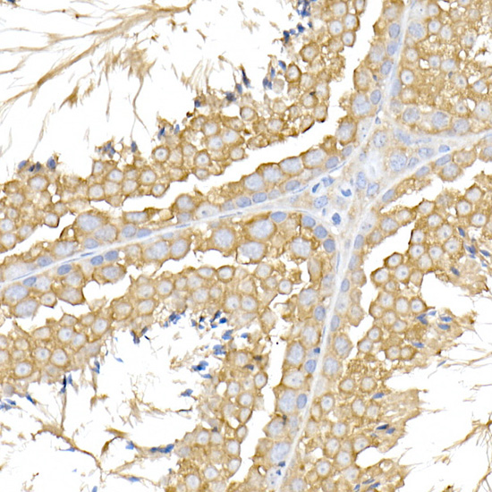 Immunohistochemistry of paraffin-embedded mouse testis using USP9Y Polyclonal Antibody at dilution of 1:100 (40x lens).Perform high pressure antigen retrieval with 10 mM citrate buffer pH 6.0 before commencing with IHC staining protocol.