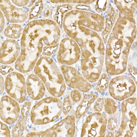 Immunohistochemistry of paraffin-embedded rat kidney using USP9Y Polyclonal Antibody at dilution of 1:100 (40x lens).Perform high pressure antigen retrieval with 10 mM citrate buffer pH 6.0 before commencing with IHC staining protocol.