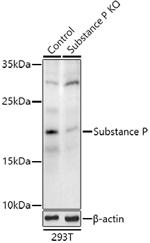 Western blot analysis of extracts from normal (control) and Substance P knockout (KO) 293T cells, using Substance P Polyclonal Antibody at 1:500 dilution.