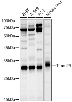 Western blot analysis of extracts of various cell lines using Timm29  Polyclonal Antibody at 1:1000 dilution.