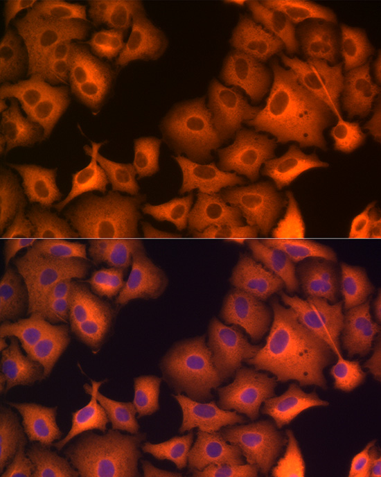 Immunofluorescence analysis of A-549 cells using HSP70 Polyclonal Antibody at dilution of 1:100 (40x lens). Blue: DAPI for nuclear staining.