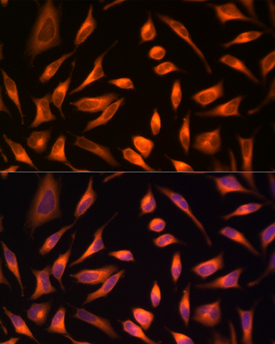 Immunofluorescence analysis of HeLa cells using HSP70 Polyclonal Antibody at dilution of 1:100 (40x lens). Blue: DAPI for nuclear staining.