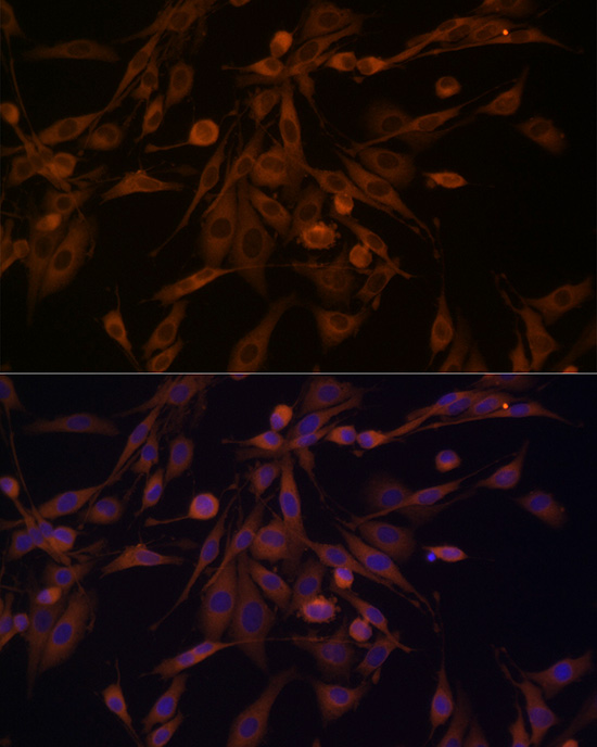 Immunofluorescence analysis of PC-12 cells using HSP70 Polyclonal Antibody at dilution of 1:100 (40x lens). Blue: DAPI for nuclear staining.