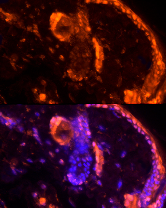 Immunofluorescence analysis of rat skin using LORICRIN Polyclonal Antibody at dilution of 1:200 (40x lens). Blue: DAPI for nuclear staining.