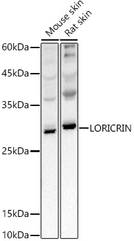 Western blot analysis of extracts of various cell lines using LORICRIN  Polyclonal Antibody at 1:1000 dilution.