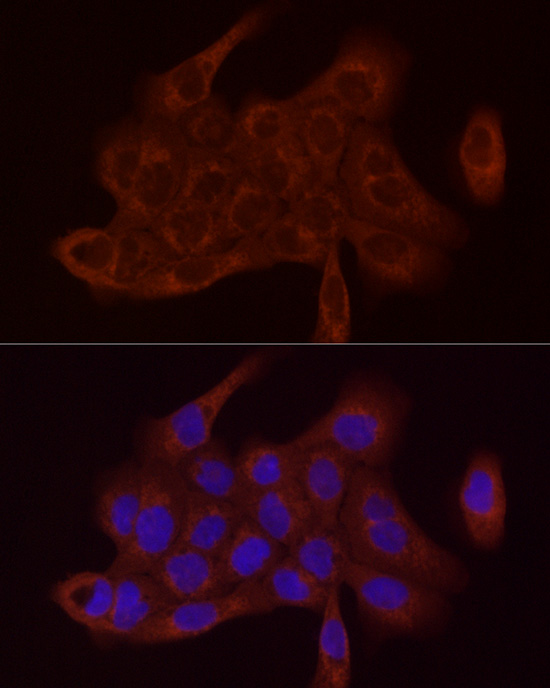 Immunofluorescence analysis of A-431 cells using SDHC Polyclonal Antibody at dilution of 1:100 (40x lens). Blue: DAPI for nuclear staining.