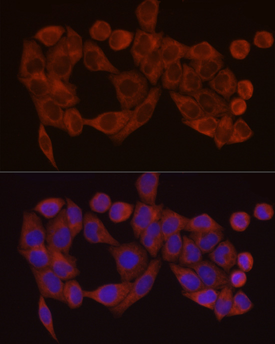 Immunofluorescence analysis of HeLa cells using SDHC Polyclonal Antibody at dilution of 1:100 (40x lens). Blue: DAPI for nuclear staining.