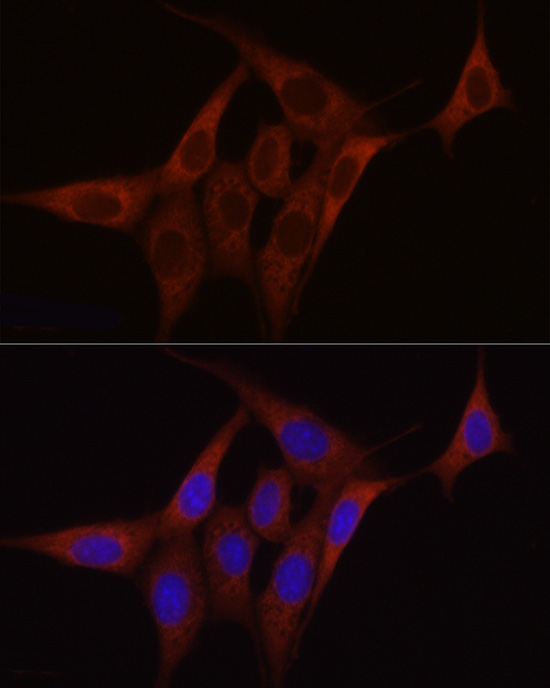 Immunofluorescence analysis of NIH/3T3 cells using SDHC Polyclonal Antibody at dilution of 1:100 (40x lens). Blue: DAPI for nuclear staining.