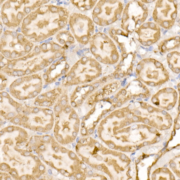 Immunohistochemistry of paraffin-embedded rat kidney using SDHC Polyclonal Antibody at dilution of 1:100 (40x lens).Perform high pressure antigen retrieval with 10 mM citrate buffer pH 6.0 before commencing with IHC staining protocol.