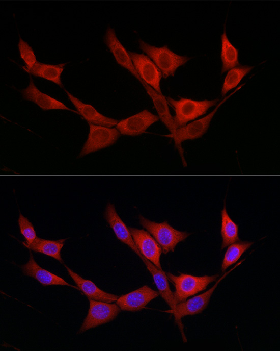 Immunofluorescence analysis of NIH/3T3 cells using KATNB1 Polyclonal Antibody at dilution of 1:200 (40x lens). Blue: DAPI for nuclear staining.