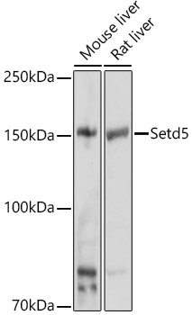 Western blot analysis of extracts of various cell lines using Setd5 Polyclonal Antibody at 1:500 dilution.