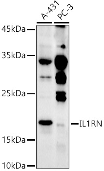 Western blot analysis of extracts of various cell lines using IL1RN Polyclonal Antibody at 1:500 dilution.