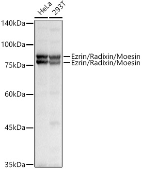 Western blot analysis of extracts of various cell lines using Ezrin/Radixin/Moesin Polyclonal Antibody at 1:1000 dilution.