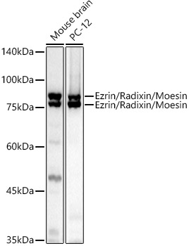 Western blot analysis of extracts of various cell lines using Ezrin/Radixin/Moesin Polyclonal Antibody at 1:1000 dilution.