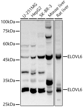 Western blot analysis of extracts of various cell lines using ELOVL6 Polyclonal Antibody at 1:1000 dilution.